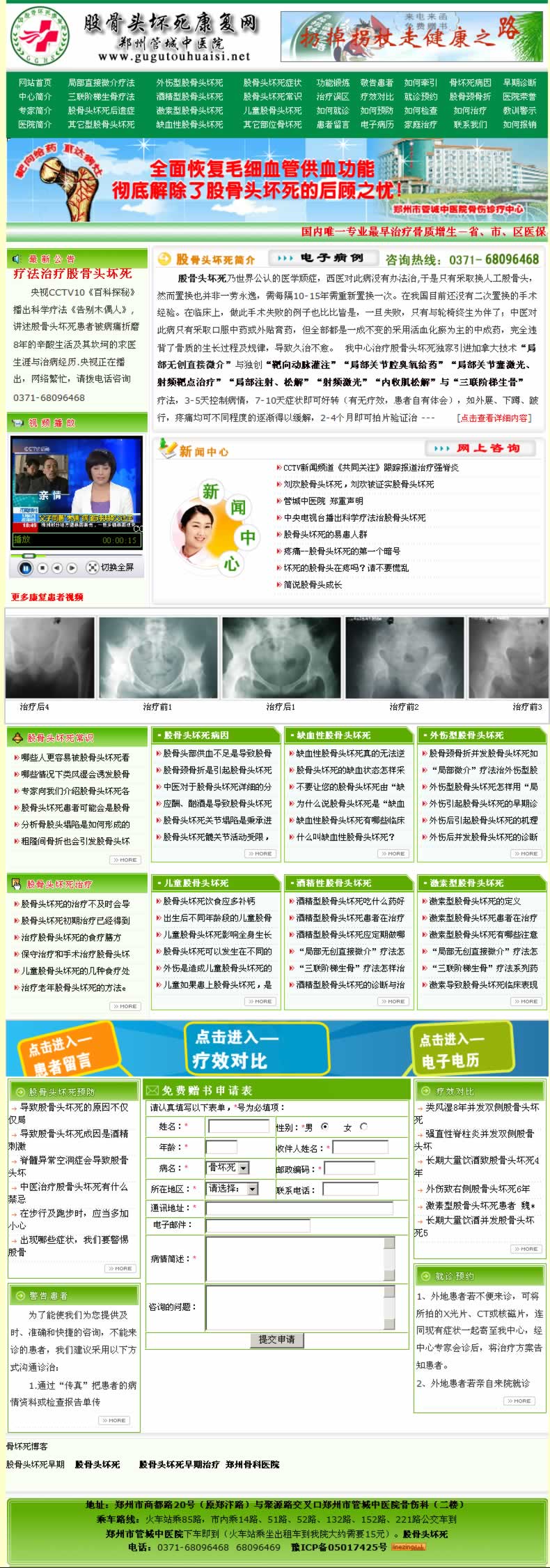 管城中醫(yī)院骨壞死康復(fù)網(wǎng) 管城中醫(yī)院骨壞死康復(fù)網(wǎng)